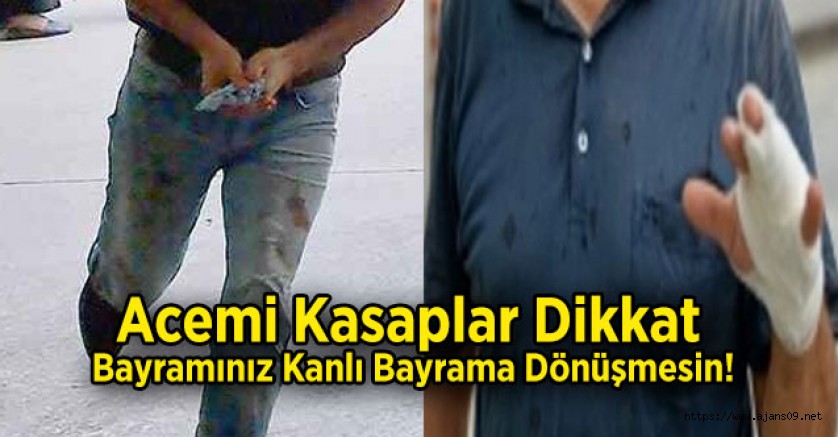 Acemi Kasaplar Dikkat, Bayramınız Kanlı Bayrama Dönüşmesin!